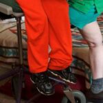 oldest-living-conjoined-twins,-lori-and-george-schappell,-die-at-62