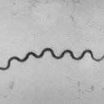 as-syphilis-cases-among-us-newborns-soar,-doctors-group-advises-more-screening-during-pregnancy