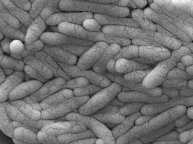 usda-tells-producers-to-reduce-salmonella-in-certain-frozen-chicken-products