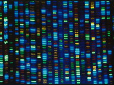 takeaways-from-ap’s-report-on-access-to-gene-therapies-for-rare-diseases