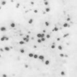 most-kids-get-antibiotics-for-pink-eye,-study-shows.-experts-say-they’re-usually-not-needed