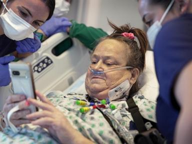 a-woman-who-received-a-pig-kidney-transplant-plus-a-heart-pump-has-died