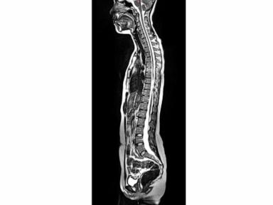 celebrities-are-getting-$2,000-mri-scans-to-learn-about-their-health.-should-you?