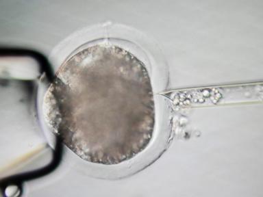 meet-some-of-the-world’s-cleanest-pigs,-raised-to-grow-kidneys-and-hearts-for-humans