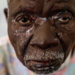 africa-has-almost-4,000-new-mpox-cases-in-a-week,-but-the-wait-for-vaccines-continues