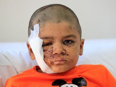 what-obstacles-stand-in-the-way-of-an-israel-hezbollah-cease-fire?