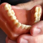 don’t-fall-for-fake-dentists-offering-veneers-and-other-dental-work-on-social-media