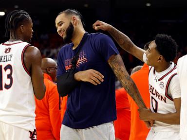 auburn-standout-center-johni-broome-injures-right-shoulder-in-victory-over-georgia-state