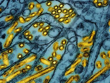 california-declared-an-emergency-over-bird-flu.-how-serious-is-the-situation?