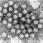 nasty-norovirus-is-back-in-full-force-with-us-cases-of-the-stomach-virus-surging