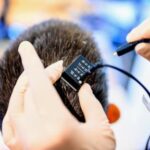 stroke-survivor-speaks-again-with-the-help-of-an-experimental-brain-computer-implant