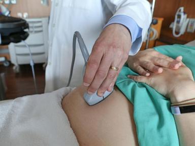 us-maternal-death-rate-rose-slightly-last-year,-health-officials-say