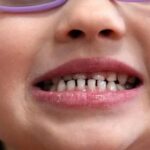 fda-and-rfk-jr.-aim-to-remove-fluoride-supplements-used-to-protect-kids’-teeth