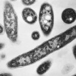 4th-person-dies-after-a-legionnaires’-disease-outbreak-sickens-dozens-in-new-york