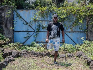 on-the-front-line-of-congo’s-conflict,-a-trauma-center-tells-a-story-of-horror-and-survival