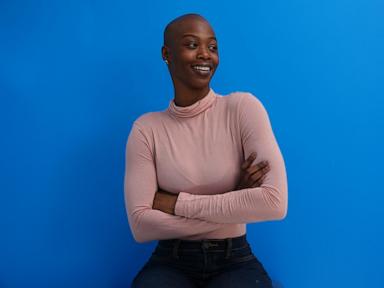 with-confidence-and-support,-more-women-are-redefining-baldness-as-beautiful