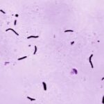 global-tuberculosis-diagnoses-rise-to-a-record,-but-deaths-fall,-who-reports