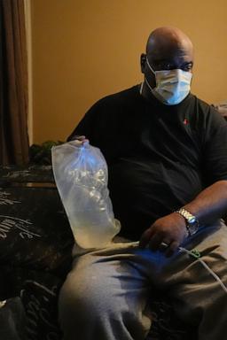 to-find-living-donors-for-kidney-transplants,-a-pilot-program-turns-to-social-networks