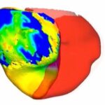 to-fix-a-patient’s-irregular-heartbeat,-doctors-first-tested-its-digital-‘twin’