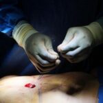 cosmetic-interventions-are-booming.-many-say-ethical-conversations-are-lagging