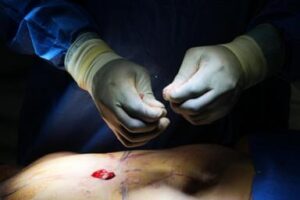 cosmetic-interventions-are-booming.-many-say-ethical-conversations-are-lagging