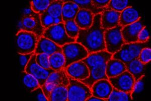 experimental-pill-promises-new-hope-for-deadly-pancreatic-cancer