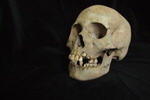 ancient-teeth-rewrite-the-plague’s-timeline,-dating-back-to-over-5,500-years-ago