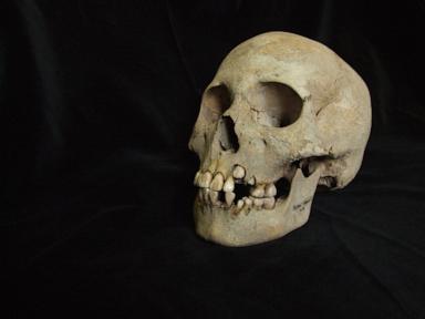 ancient-teeth-rewrite-the-plague’s-timeline,-dating-back-to-over-5,500-years-ago