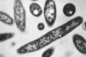 what-to-know-about-legionnaires’-disease-making-people-sick-on-new-york’s-upper-east-side