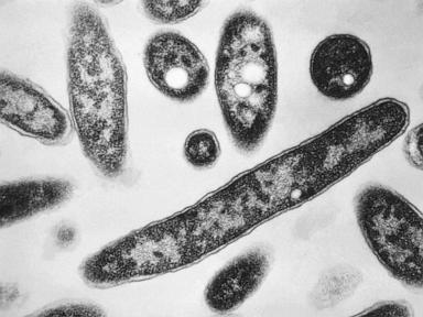 what-to-know-about-legionnaires’-disease-making-people-sick-on-new-york’s-upper-east-side
