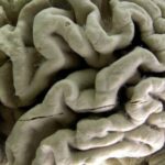 blood-test-can-help-identify-people-at-high-risk-for-alzheimer’s,-study-shows